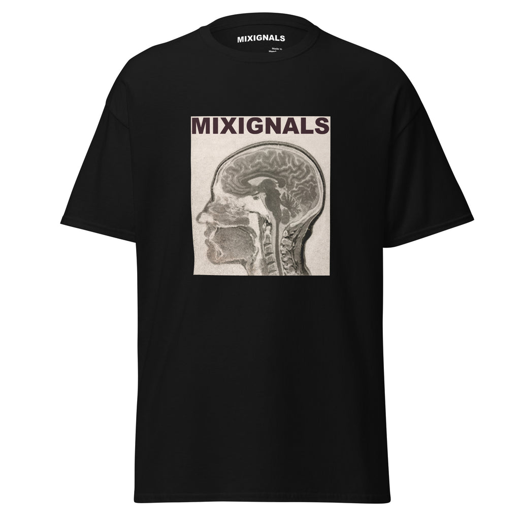 BRAIN SCAN print on black unisex t-shirt, front view – sepia MRI brain scan in profile – MIXIGNALS