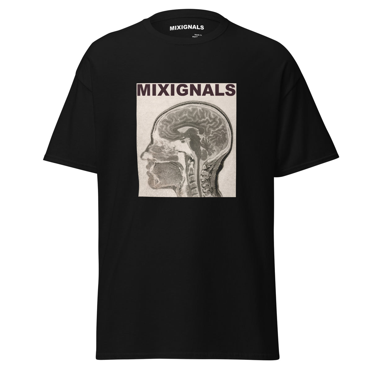 BRAIN SCAN print on black unisex t-shirt, front view – sepia MRI brain scan in profile – MIXIGNALS